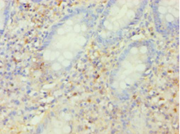 KCNJ10 Polyclonal Antibody