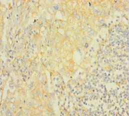 AKT2 Polyclonal Antibody