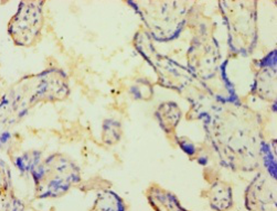 CSNK1E Polyclonal Antibody
