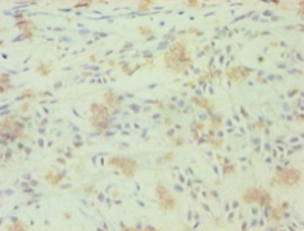 RORC Polyclonal Antibody