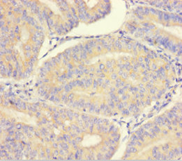 LMAN1L Polyclonal Antibody