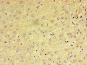PRAME Polyclonal Antibody