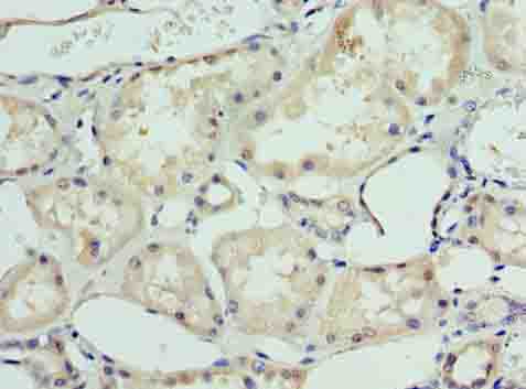 DHX9 Polyclonal Antibody