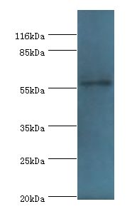 RAD18 Polyclonal Antibody