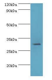 HSD11B1 Polyclonal Antibody