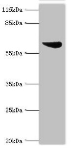 ASH2L Polyclonal Antibody (100 µl)