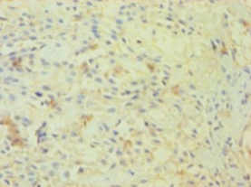 OGT Polyclonal Antibody