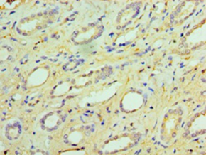 GUCA2B Polyclonal Antibody