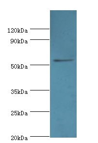 EPHX1 Polyclonal Antibody