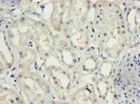 NPHS1 Polyclonal Antibody