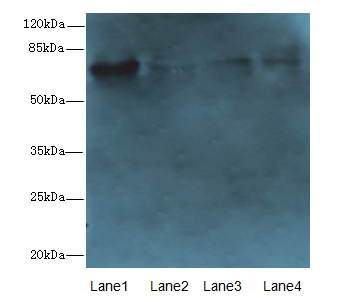 PADI2 Polyclonal Antibody