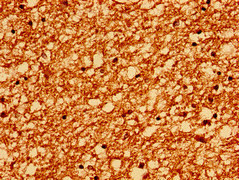 PTPRZ1 Polyclonal Antibody