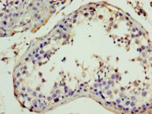 ITIH4 Polyclonal Antibody