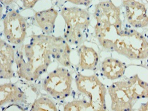 DCUN1D1 Polyclonal Antibody (50 µl)