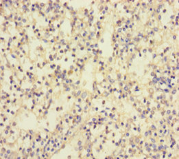 TLN1 Polyclonal Antibody