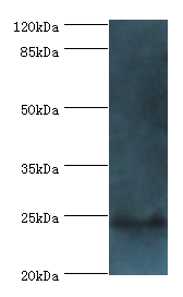 FKBP3 Polyclonal Antibody
