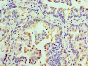 RMDN3 Polyclonal Antibody