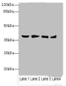 AKR1C2 Polyclonal Antibody