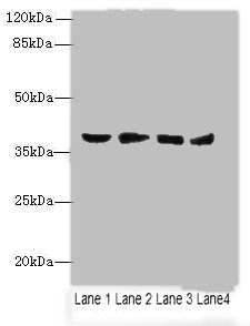 AKR1C2 Polyclonal Antibody (100 µl)