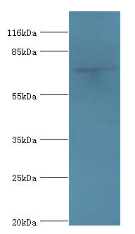 MTMR7 Polyclonal Antibody