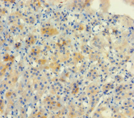 NUP153 Polyclonal Antibody