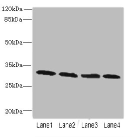 PNP Polyclonal Antibody