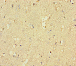 PTPRZ1 Polyclonal Antibody