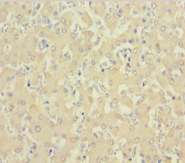 C1D Polyclonal Antibody