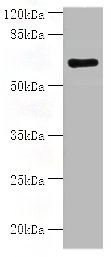 Histone Acetyltransferase KAT7 Polyclonal Antibody (100 µl)