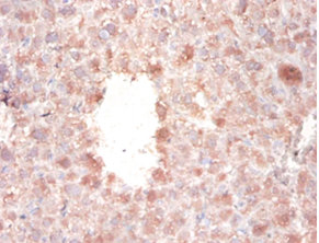 Immunohistochemistry of paraffin-embedded mouse liver tissue at dilution 1:100
