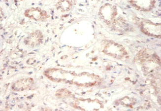 Immunohistochemistry of paraffin-embeded human kidney using YWHAB Polyclonal Antibody at dilution of 1:50