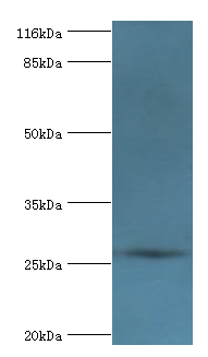 OFCC1 Polyclonal Antibody