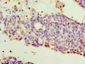 WT1 Polyclonal Antibody