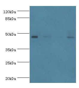 INHBA Polyclonal Antibody