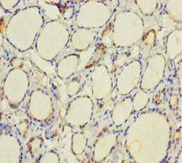 TPO Polyclonal Antibody