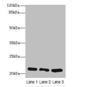 GM2A Polyclonal Antibody