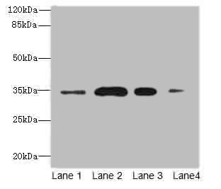 SULT1A3 Polyclonal Antibody