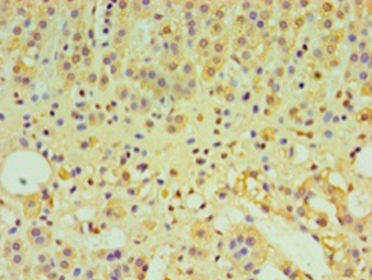 IFNL1 Polyclonal Antibody