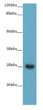 Western blot<br />All lanes: TMEM98 Antibody at 2ug/ml+Mouse lung tissue<br />Goat polyclonal to rabbit IgG at 1/10000 dilution<br />Predicted band size: 25 kDa<br />Observed band size: 25 kDa<br />