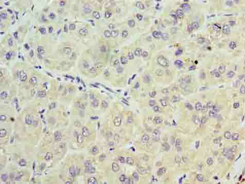 TRBC1 Polyclonal Antibody