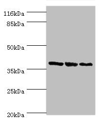 GALE Polyclonal Antibody (100 µl)