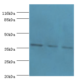 GALE Polyclonal Antibody