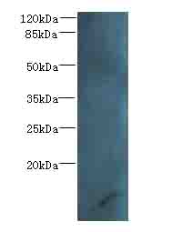 Western blot<br />All lanes: ZNRD1 Polyclonal Antibody at 14ug/ml+ Human high value serumGoat polyclonal to rabbit at 1/10000 dilution<br />Predicted band size: 14 kDa <br />Observed band size: 14 kDa <br />