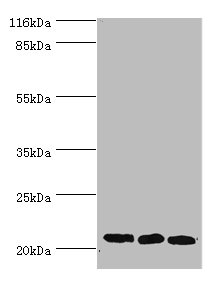SSSCA1 Polyclonal Antibody (100 µl)