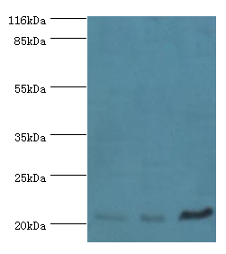SSSCA1 Polyclonal Antibody