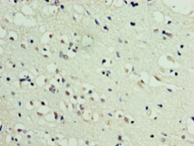 DBNDD2 Polyclonal Antibody