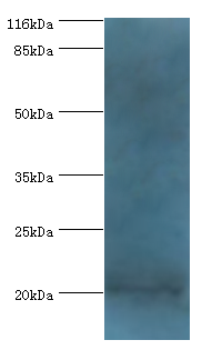 NTS Polyclonal Antibody