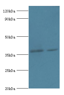 DHRS7 Polyclonal Antibody