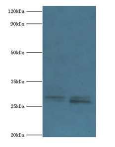 PIGX Polyclonal Antibody