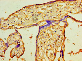 Immunohistochemistry of paraffin-embedded human placenta tissue using PIGX Polyclonal Antibody at dilution 1:100